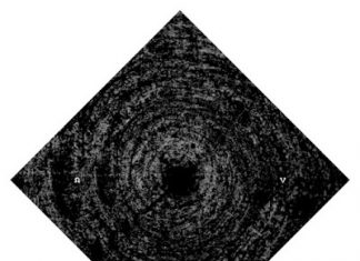 Ainsoph – Ω – V Review